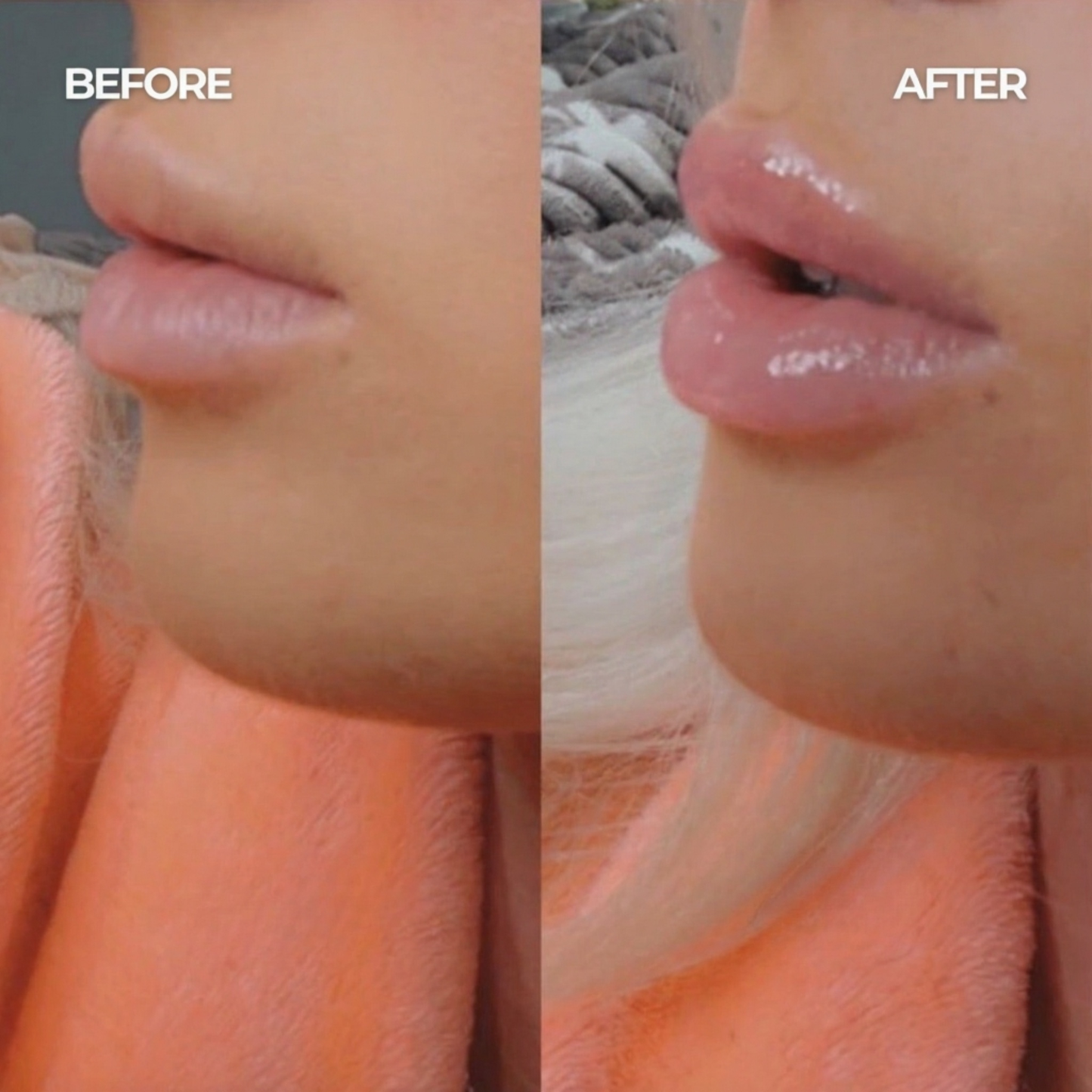 Melora Volumising Lip Plumper