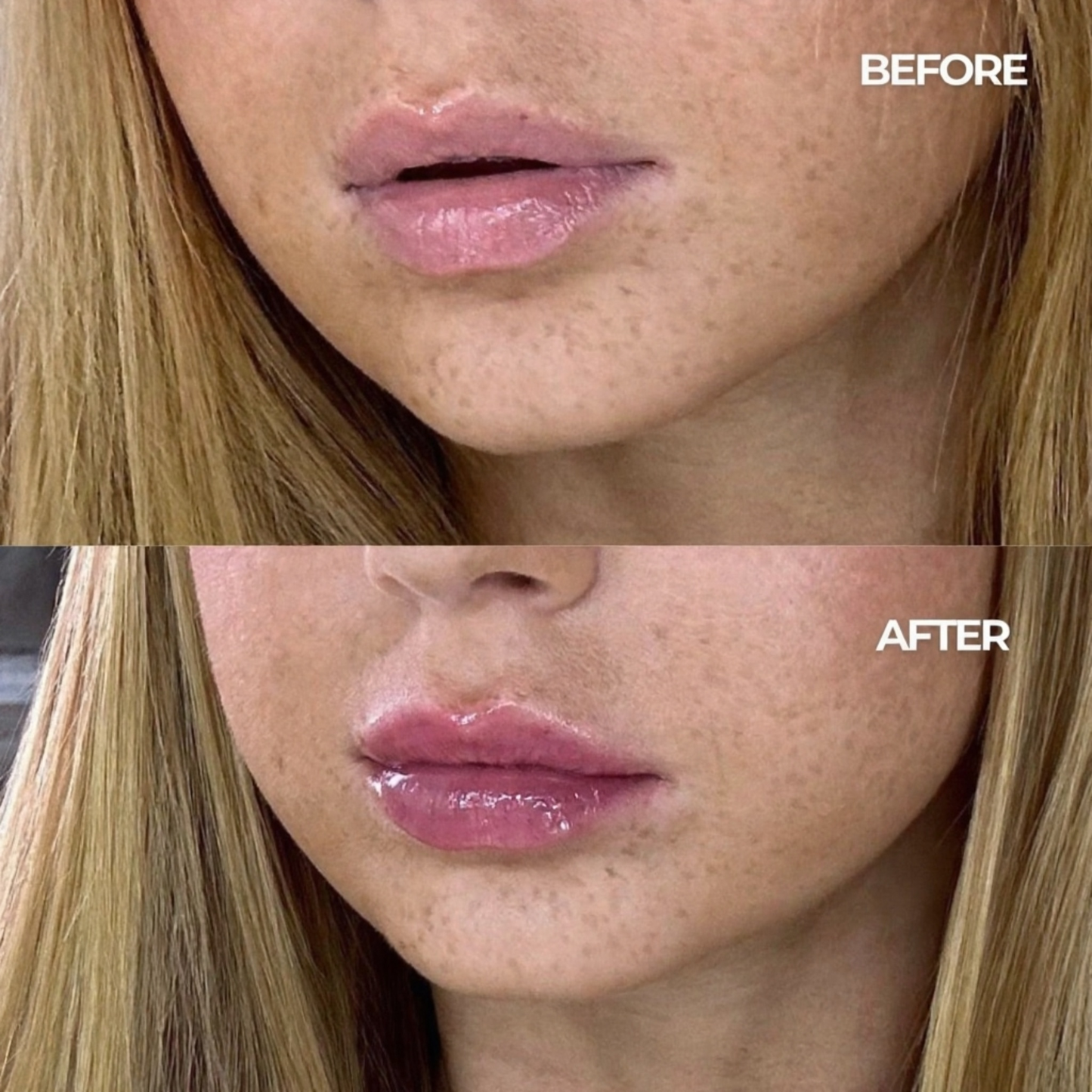 Melora Volumising Lip Plumper