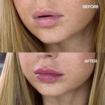 Melora Volumising Lip Plumper